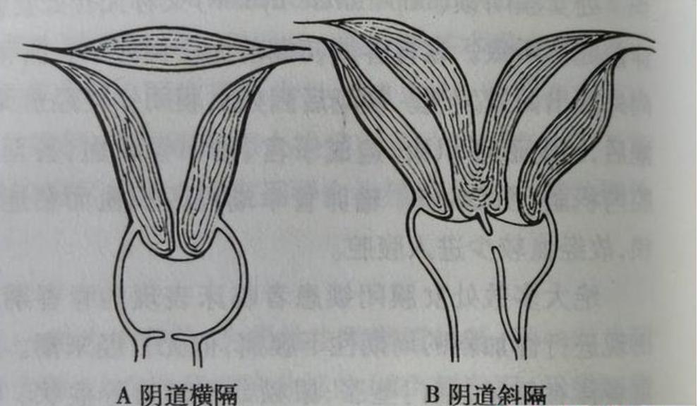 冯八买八二带来,五不旺来也不弱是打猜一准确最佳生肖，详细解答、专家解答解释落实