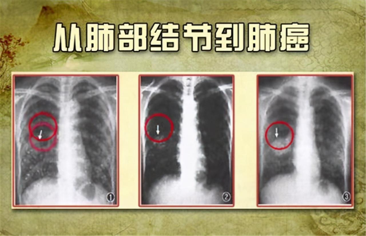 乾坤运转喜事多 金木五行在本期指的是什么生肖，详细解答、时代解答解释落实