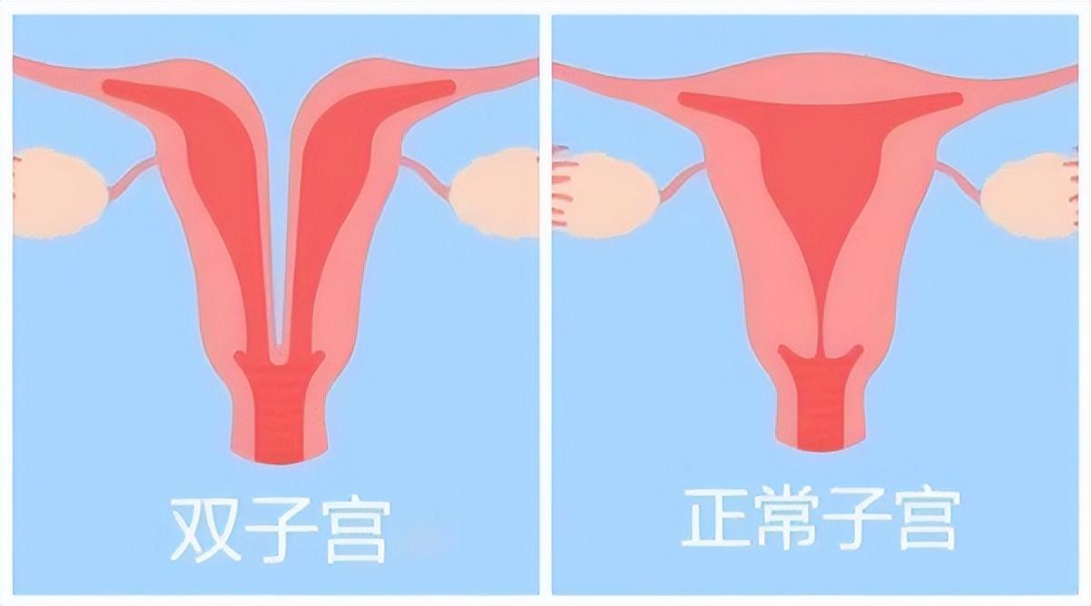 乾坤运转喜事多 金木五行在本期指的是什么生肖，详细解答、时代解答解释落实